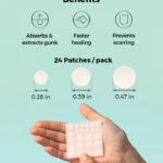 [COSRX] Acne Pimple Master 24 patches